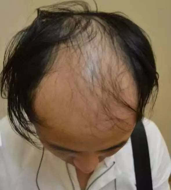 黑暗中的五彩人生点击答案_黑暗中的五彩人生答案_20岁就秃顶了人生都黑暗了