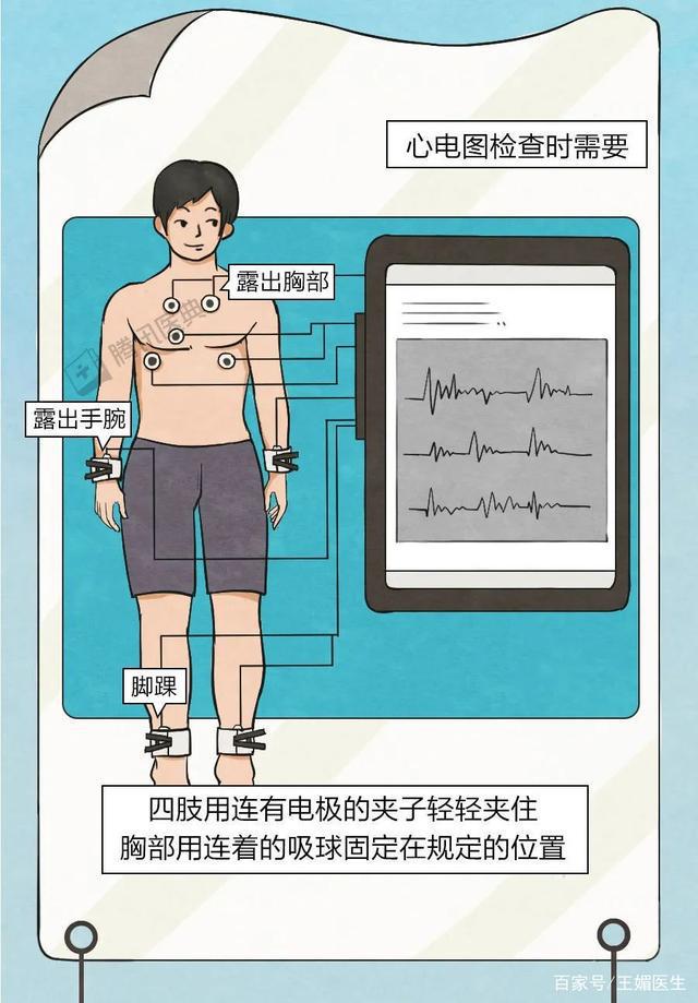 手机怎么测心电图_手机测心电图软件能出报告吗_手机测心电图软件下载