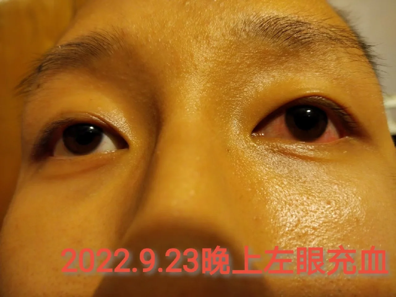 伤眼睛的手机屏幕_游戏手机屏幕伤眼吗_伤眼的手机